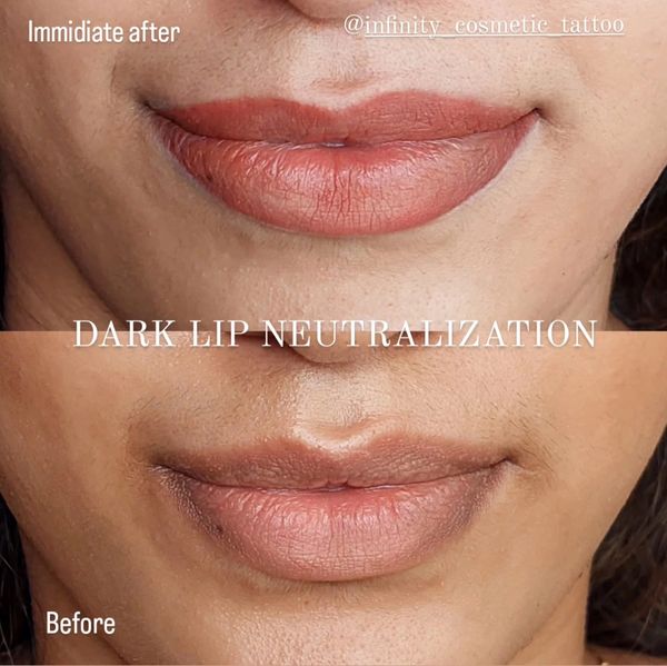Lip tattoo near me
Lip blush tattoo gold coast
Datk lip lightening gold coast
Dark lipneutraluzation