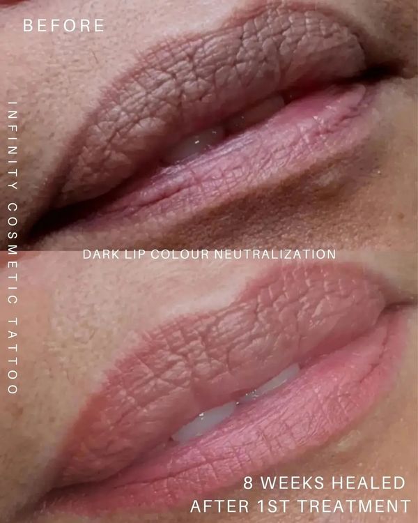 dark lip correction gold coast
dark lip neutralisation gold coast
dark lip blush tattoo gold coast
