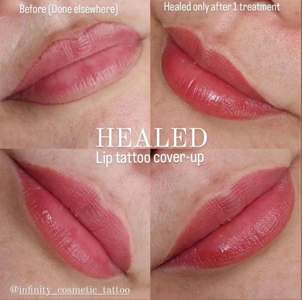 lip cosmetic tattoo
lip blush tattoo
lip blushing
lip blush tattoo
lip tattoo
permanent lip tattoo