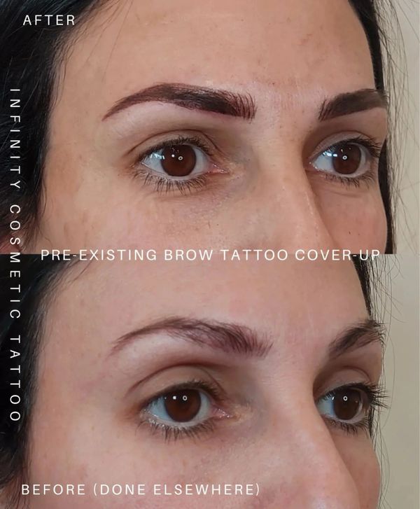 eyebrow tattoo correction gold coast
eyebrow tattoo coverup gold coast
eyebrow tattoo fix gold coast