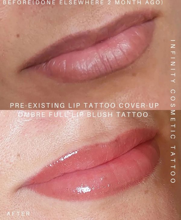 lip tattoo correction gold coast
cosmetic tattoo gold coast
lip tattoo fix gold coast