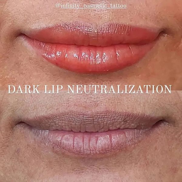 dark lip correction gold coast
dark lip neutralisation gold coast
dark lip blush tattoo gold coast