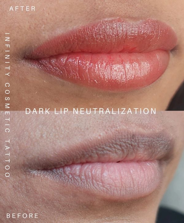 dark lip correction gold coast
dark lip neutralisation gold coast
dark lip blush tattoo gold coast