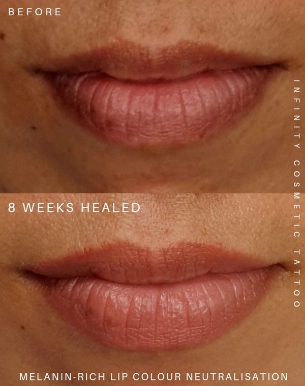 dark lip correction gold coast
dark lip neutralisation gold coast
dark lip blush tattoo gold coast