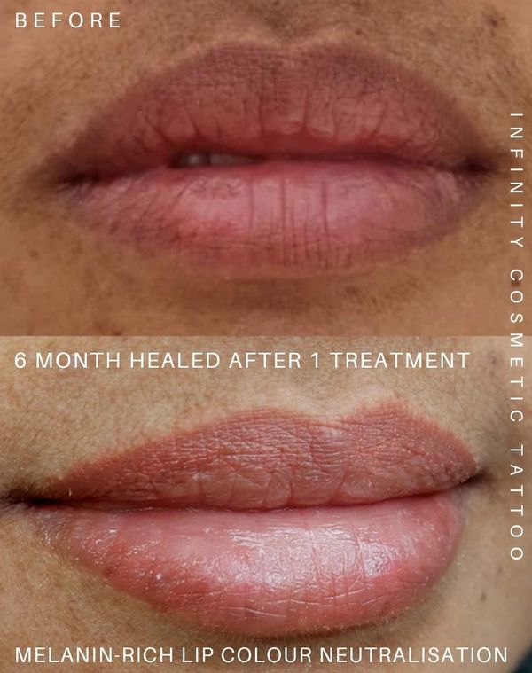 dark lip correction gold coast
dark lip neutralisation gold coast
dark lip blush tattoo gold coast