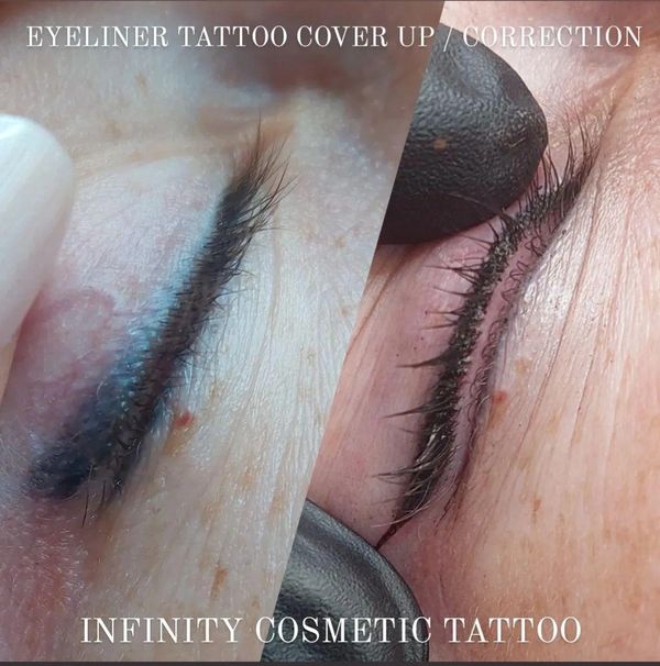 permanent eyeliner tattoo correction gold coast
eyeliner tattoo fix gold coast
eyeliner tattoo