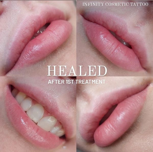 healed lip blush tattoo gold coast
lip blushing gold coast
lip tattoo gold coast
lip blush varsity