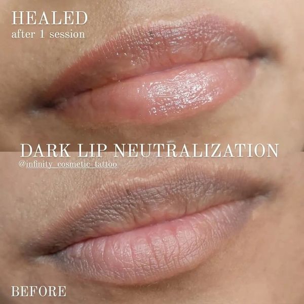 Healed lip blush tattoo
Healed dark lip correction
Dark lip correction gold coast
Dark lips near me