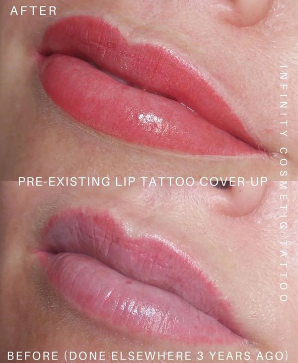 eyebrow tattoo correction gold coast
cosmetic tattoo gold coast
eyebrow tattoo fix gold coast