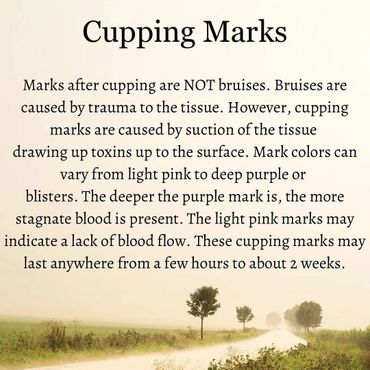 Cupping marks explained