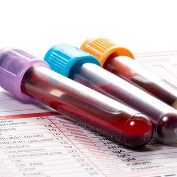 Image of three vials of blood with different colored caps