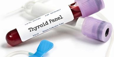 Thyroid panel blood test serum collection tube with expiration date and lot number for TSH T3 T4 hor