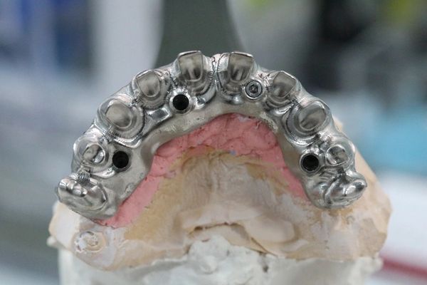Titanium framework of an all on 4 dental implant retained bridge