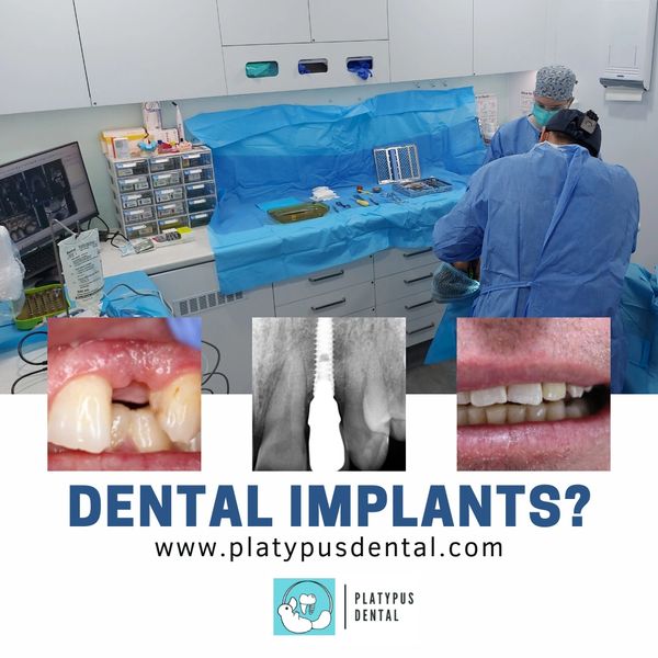 Dental implant at Platypus Dental dentist strathpine