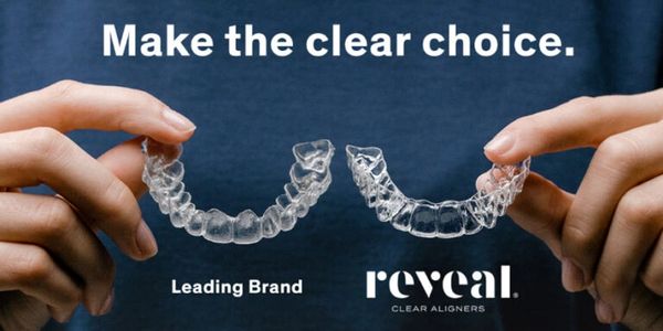 Comparing Reveal Clear Aligners with Invisalign
