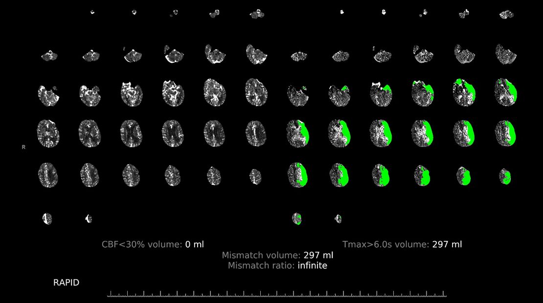MRI scan of the brain.