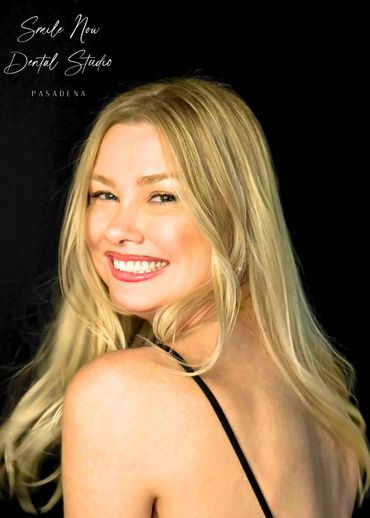 Conservative smile makeover using dental bonding to close gaps and repair chips in Pasadena.