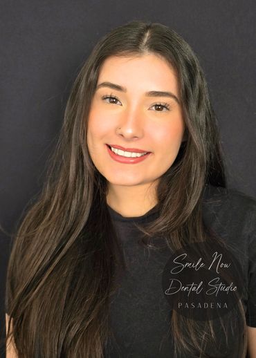 Anti-aging smile rejuvenation using porcelain veneers and crowns for patients in South Pasadena.