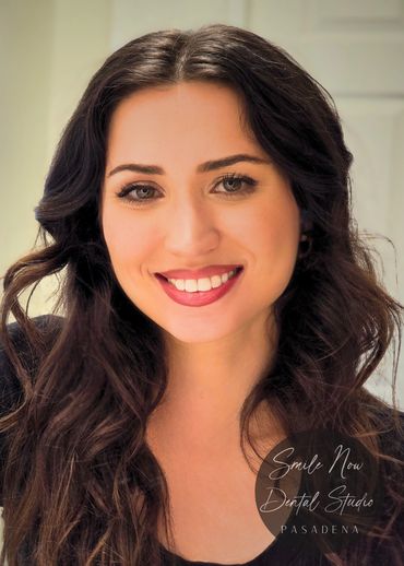 Instant smile makeover results with cosmetic dental bonding for South Pasadena residents.
