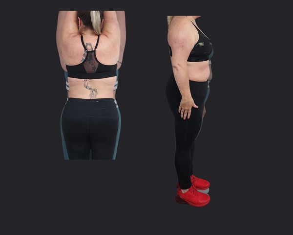 Whole Body Body Sculpting | Before and After Body Sculpting