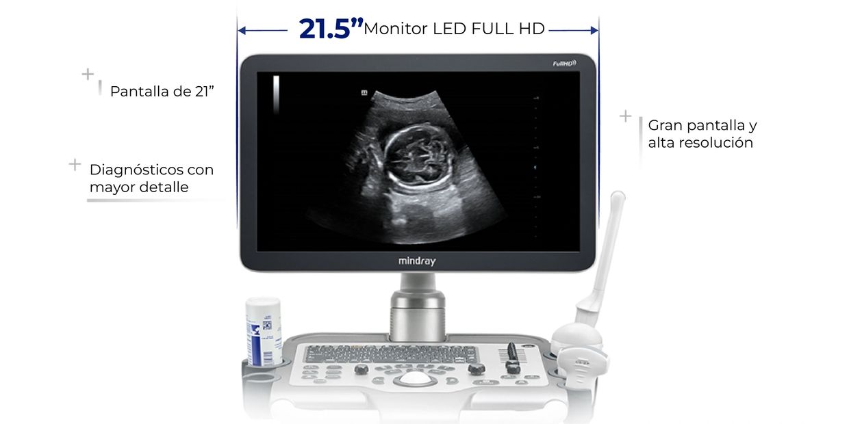 Mindray DC-30 FULL HD