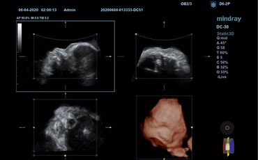 Obstetricia