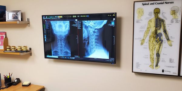 Quiropractico Stamford CT, quiropractico en espanol, dolor espalda, dolor cuello, accidente de carro