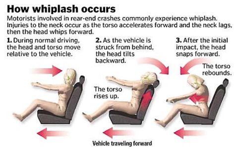 Chiropractor Stamford CT, Auto accident, lawyer, whiplash, concussion, headaches, neck and back pain