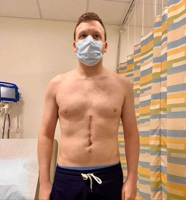 Man with surgical scar on chest wearing mask in hospital room.