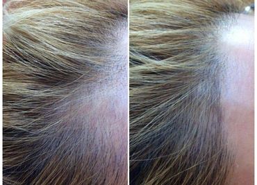 Close-up of hair roots showing regrowth.