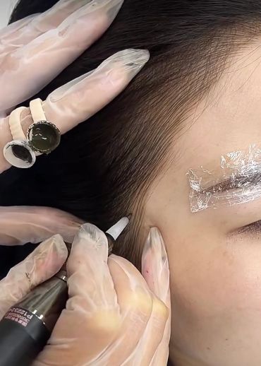 Microblading procedure on hairline and eyebrow area.