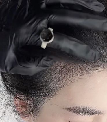 Gloved hand holding a ring near a person's head.
