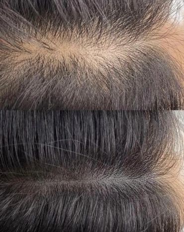 Top shows thinning hair; bottom shows thicker hair.