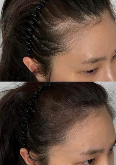 Side view of a woman wearing a black hairband.