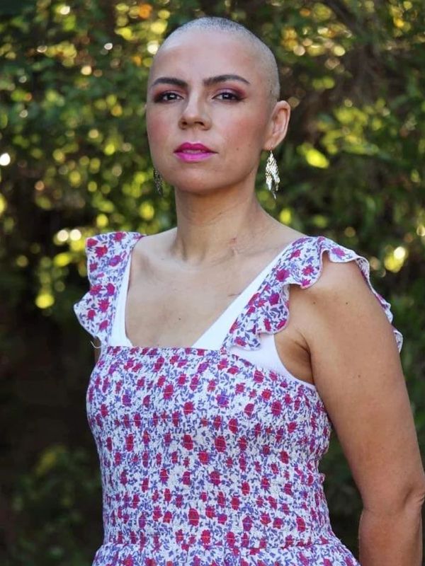 Portrait of myself in January 2022 after losing my hair due to chemotherapy for my Breast cancer k