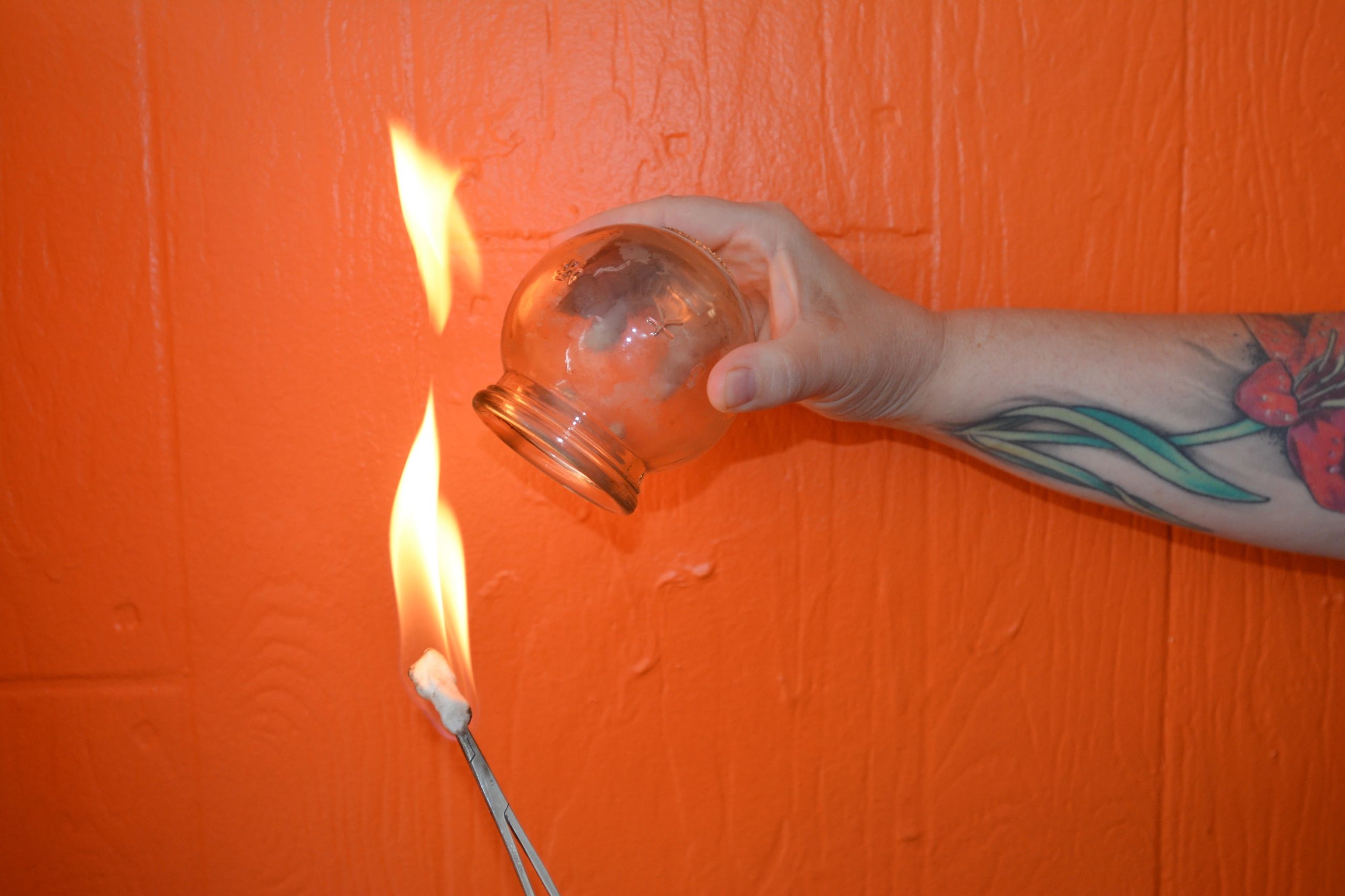 A picture of Jenn doing Fire cupping with an orange background. 