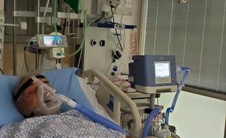 bilateral bronchopneumonia,organism-H Influenza. Respiratory sepsis. Initially Type 1 Respiratory fa