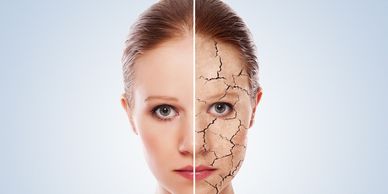 Dry or dehydrated skin can be treated with hydrofacials.