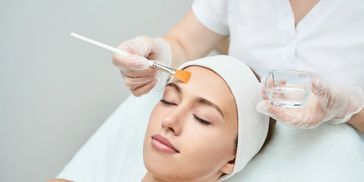 TCA Peel Application for a deeper peel.