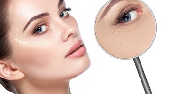 Eye area rejuvenation can be achieved with eye peels, plasma pen & fractional RF.