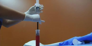 stem cells, stem cell clinics, Maggie Fox, writer, health news