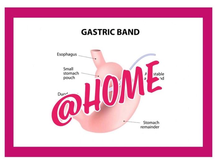 Virtual Gastric Band Hypnosis at Home