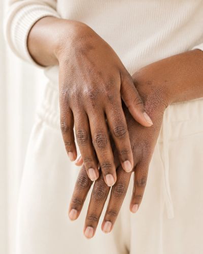 Irritating dermatitis on hands