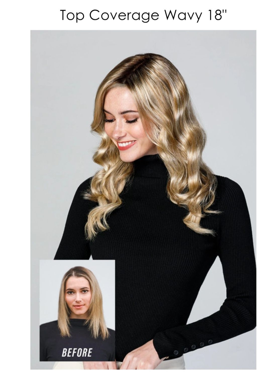 Natural looking topper for advanced stages of Hair thinning