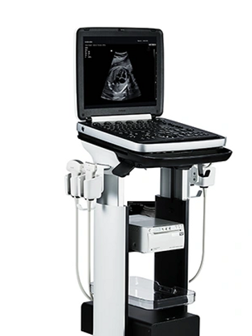 Samsung HM70 EVO Ultrasound