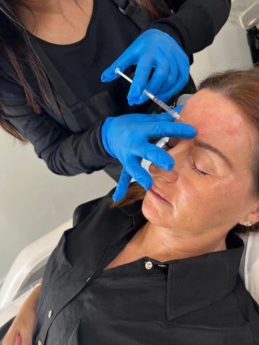 Anti wrinkle treatment