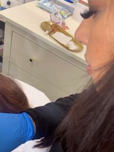 Anti-wrinkle treatment