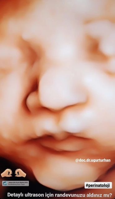 Bebeğinizin en önemli incelemesi için lütfen geç kalmayın.