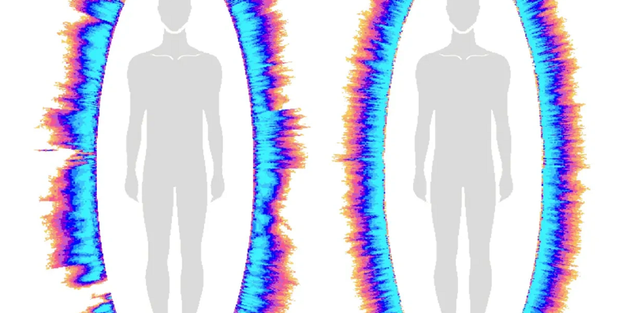 GDV reading. Energy report of inflammation & flow blockages, and of resolved energy flow.