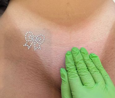 Close-up of skin with rhinestone bow decoration and a hand in a green glove.